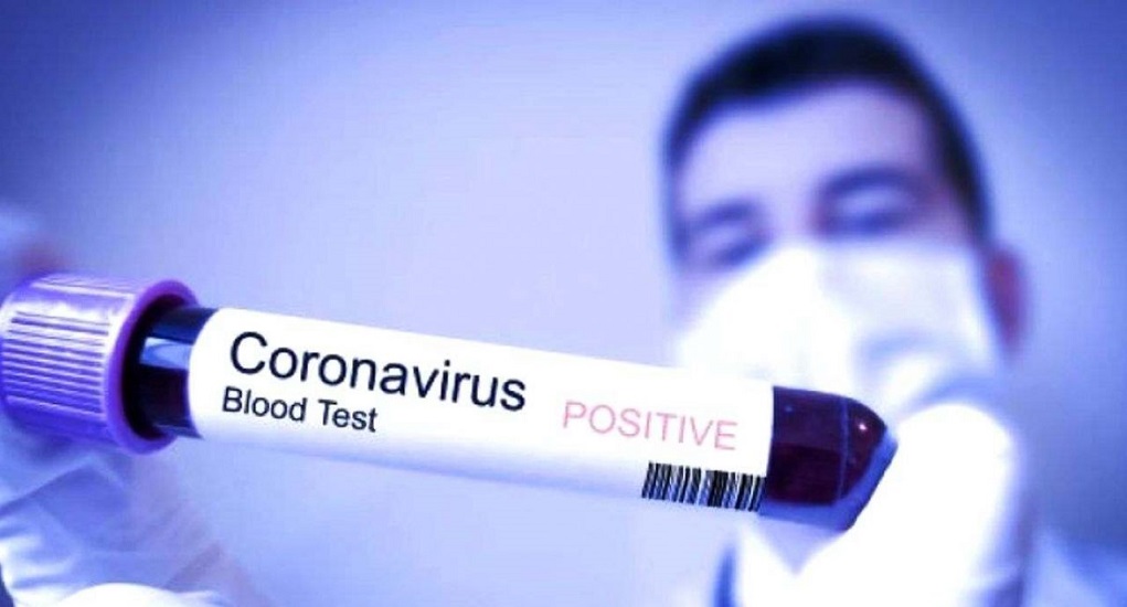 Cara Penyebaran Virus Corona dan Pencegahannya Menurut WHO